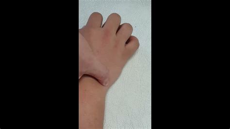 6 Manual Muscle Test MMT Wrist Flexion Extension YouTube