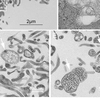 Transmission Electron Microscopy Tem Characterization Of Uscs And