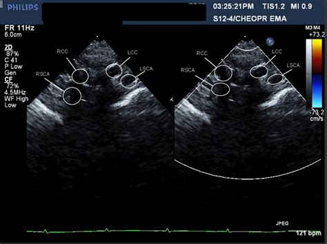 J Med Cases