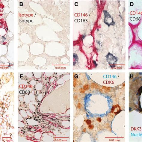 Immunohistochemical Detection Of Cd146 Cells And Cd163 Or Cd68 Download Scientific