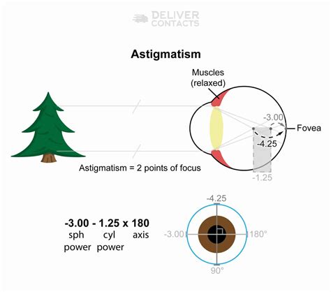 Astigmatism Definition Causes Symptoms