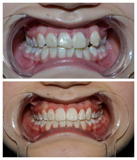 Prodent Dental Clinic Шүдний эмнэлэг