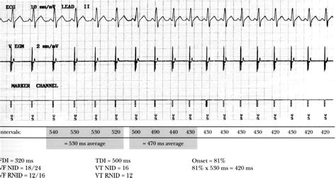 Implanted Devices And Atrial Fibrillation Intechopen