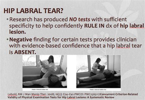 Manual Tests For Hip Labral Tear