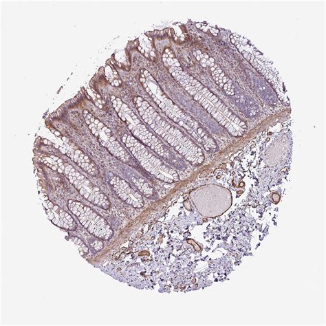 Tissue Expression Of Col8a1 Staining In Colon The Human Protein Atlas