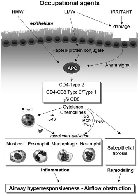 Schematic Summary Of Possible Mechanisms In Occupational Asthma Oa