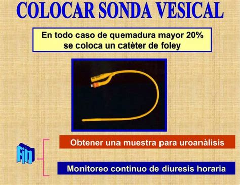 Quemaduras Uso De Sonda Vesical Alxnsx S UDocz