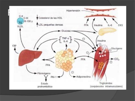 Sindrome Metabolico