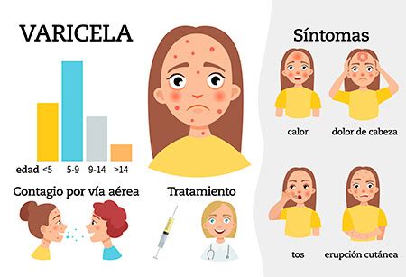 Varicela en niños contagio incubación tratamiento Todo aquí