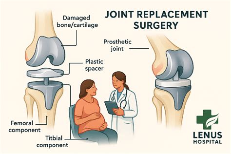 joint replacement surgery  complete guide  hip  knee replacements