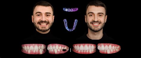 Centrul Stomatologic Dentus•Dentino Chisinau