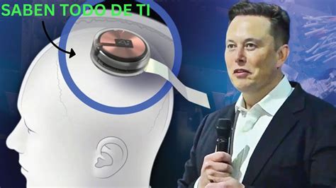 Neuralink Un Chip En Tu Cerebro La Tecnolog A De Elon Musk Youtube