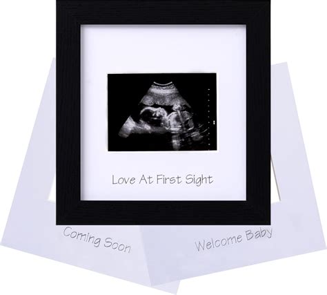 Amazon Eletecpro Ultrasound Picture Frame Display X Sonogram