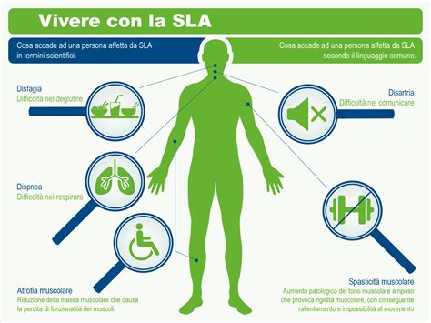 nascondere Ringhiare estensione sintomi sla bulbare È miscuglio insieme