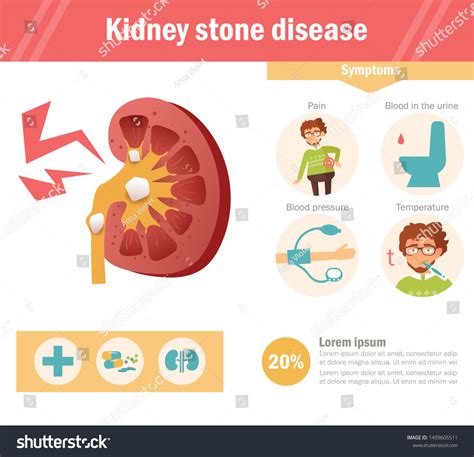 Kidney Stone Disease Vector Cartoon Isolated Stock Vector (Royalty Free ...