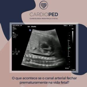 O coração CardioPED Recife Cardiologia Pediátrica e Fetal