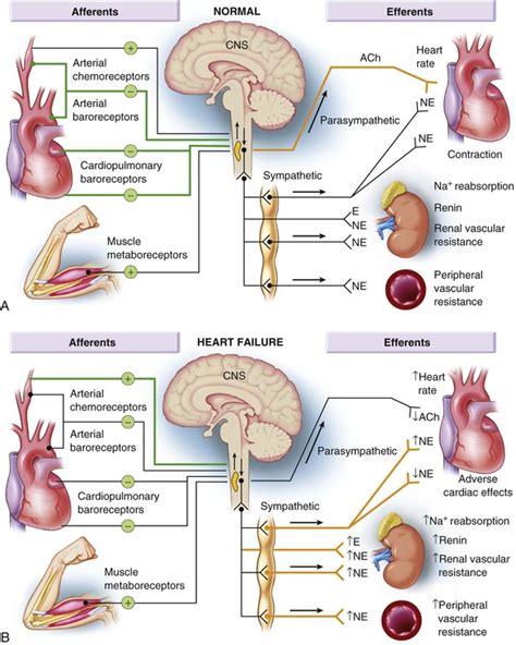 Pathophysiology Of Heart Failure Thoracic Key