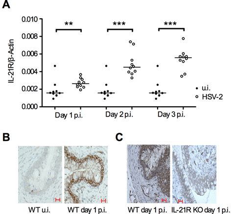 Il R Is Expressed By Vaginal Epithelial Cells In Wt Mice And Il R