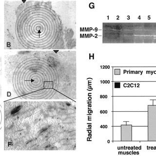 Localization And Quantification Of Myoblast Migration In Tnf Treated