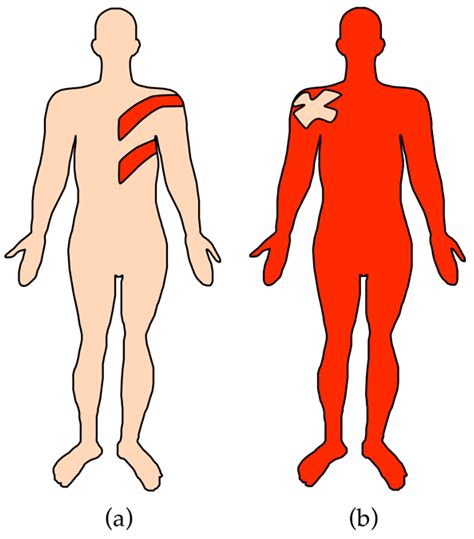 Biomedicines Free Full Text Revertant Mosaicism In Genodermatoses