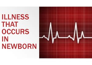 POST Maturity Pedia POST MATURE INFANT POSTMATURITY An Infant Born After Weeks Gestation