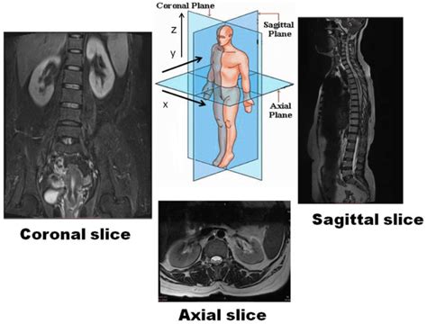 Anatomical Planes Of A Human Body As Captured During Mri Download Scientific Diagram