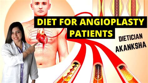 Diet After Angioplasty Surgery एंजियोप्लास्टी सर्जरी के बाद आहार