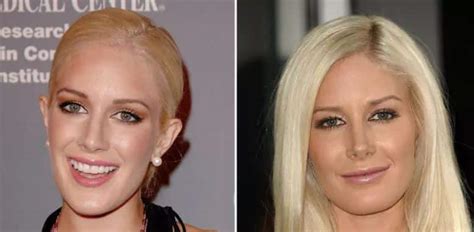 Heidi Montag Une Star De T L R Alit Transform E Par La Chirurgie