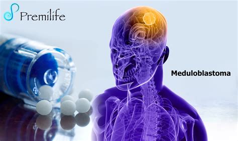 Medulloblastomas | Premilife - Homeopathic Remedies