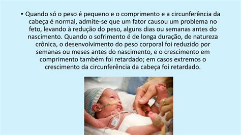 PDF Noções de Neonatologia irp cdn multiscreensite 17