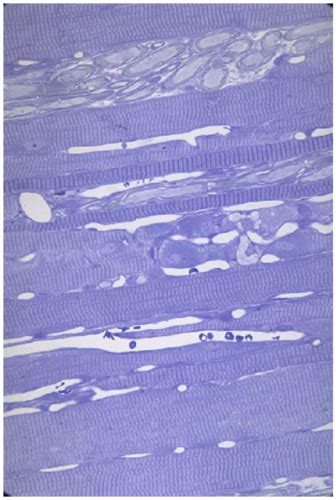 Muscle Tissue Lab Flashcards Quizlet