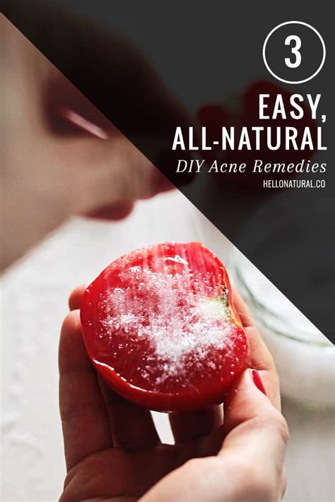 3 Easy, All-Natural DIY Acne Remedies | HelloGlow.co