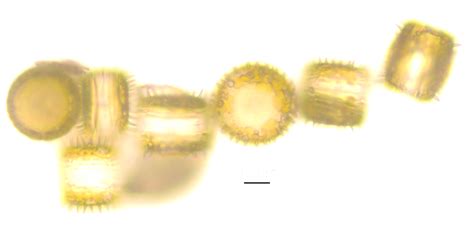 Image Livepic 40 Species Diatoms Of North America