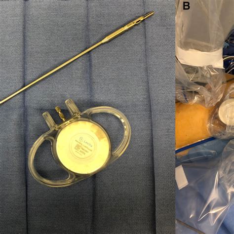 a The complete Levita™ magnetic surgical system and b external magnet ...
