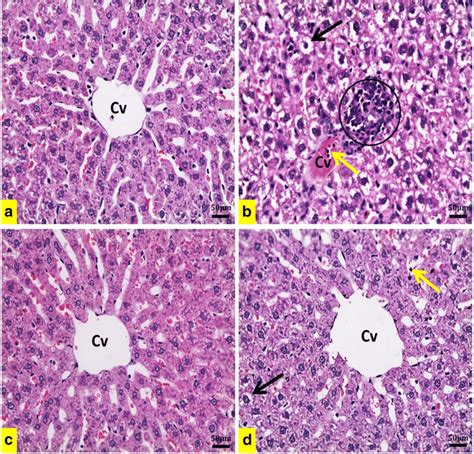 Representative Photomicrographs Of Liver Sections Hematoxylin And Download Scientific Diagram