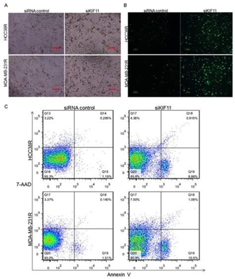 Silencing Of KIF11 Promotes Docetaxel Resistant TNBC Cell Mitosis And