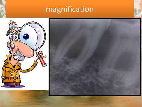 Artifact And Errors In Intraoral Periapical Radiograph Ppt