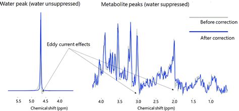 Eddy Current Correction Of In Vivo Human Brain 1 H Mr Spectra Press