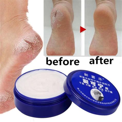 Anti Crack Foot Cream Oil Anti Drying Crack Feet Cream Heel Cracked