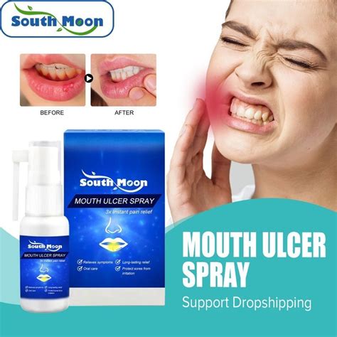 Mouth Ulcer Spray Portable Treat Oral Ulcer Blister Canker Gum Swelling