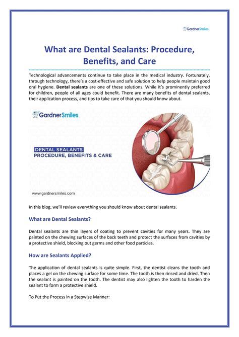 What are Dental Sealants: Procedure, Benefits, and Care by Gardner ...