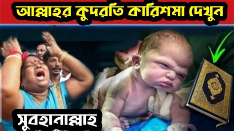 হায় আল্লাহ শিশুটির জন্মের পর ঘটে গেল একটি অলৌকিক ঘটনা আল্লাহর