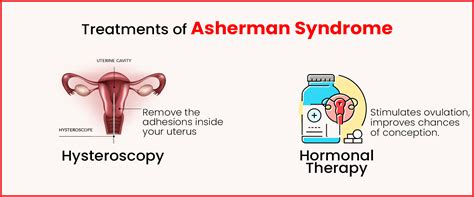 Asherman Syndrome - Causes, Symptoms, and Treatment