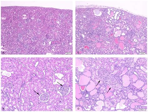 High And Low Magnification Of Hematoxylin And Eosin Stained Histologic