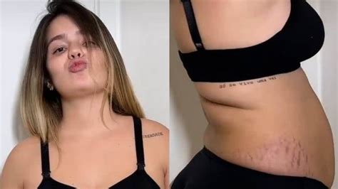 Viih Tube mostra como está seu corpo após um mês do parto Cicatrizes