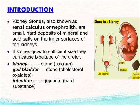 Presentation Kidney Stone Final Ppt