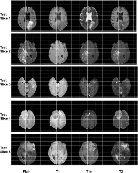 Modalities Namely Flair T1 T1c And T2 Of Input Test Images Are Shown