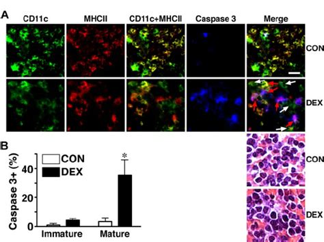 Distinct Glucocorticoid Sensitivities Of Immature And Mature DCs In