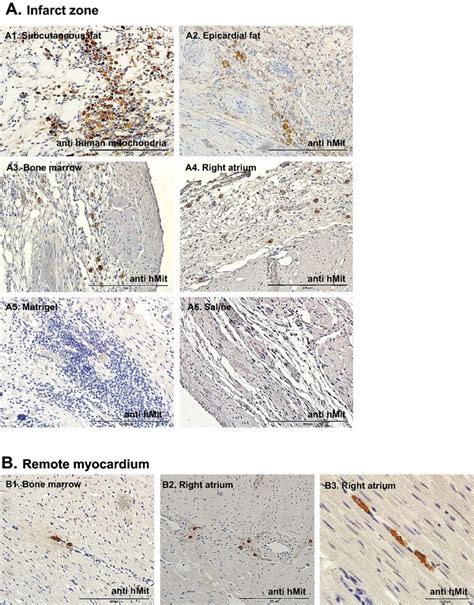 Msc Grafts In The Infarcted Myocardium Days After Transplantation In