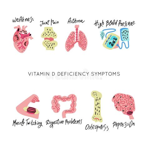 Vitamind Deficiency Stock Illustration Illustration Of Cartoon 166839411